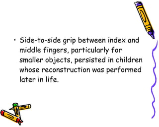 Side-to-side grip between index and middle fingers, particularly for smaller objects, persisted in children whose reconstruction was performed later in life.  