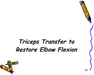 Triceps Transfer to Restore Elbow Flexion 