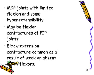 MCP joints with limited flexion and some hyperextensibility.  May be flexion contractures of PIP joints. Elbow extension contracture common as a result of weak or absent elbow flexors. 