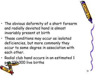 The obvious deformity of a short forearm and radially deviated hand is almost invariably present at birth  These conditions may occur as isolated deficiencies, but more commonly they occur to some degree in association with each other.  Radial club hand occurs in an estimated 1 per 100,000 live births  