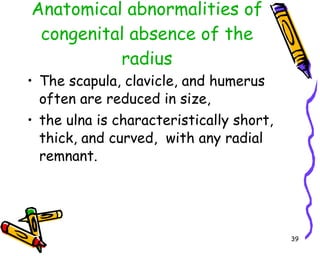 Anatomical abnormalities of congenital absence of the radius The scapula, clavicle, and humerus often are reduced in size,  the ulna is characteristically short, thick, and curved,  with any radial remnant.  