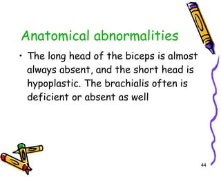 Anatomical abnormalities The long head of the biceps is almost always absent, and the short head is hypoplastic. The brachialis often is deficient or absent as well  