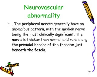 Neurovascular abnormality . The peripheral nerves generally have an anomalous pattern, with the median nerve being the most clinically significant. The nerve is thicker than normal and runs along the preaxial border of the forearm just beneath the fascia.  