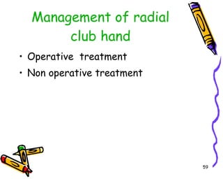 Management of radial club hand Operative  treatment Non operative treatment  