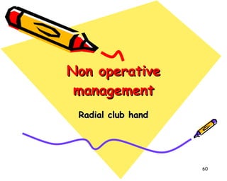 Non operative management Radial club hand 