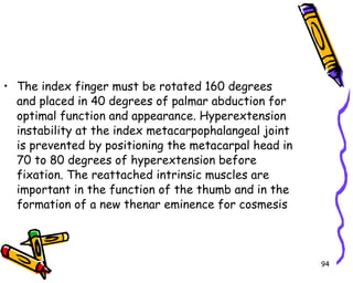 The index finger must be rotated 160 degrees and placed in 40 degrees of palmar abduction for optimal function and appearance. Hyperextension instability at the index metacarpophalangeal joint is prevented by positioning the metacarpal head in 70 to 80 degrees of hyperextension before fixation. The reattached intrinsic muscles are important in the function of the thumb and in the formation of a new thenar eminence for cosmesis  