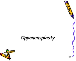 Opponensplasty 