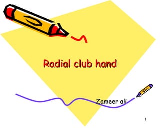 Radial club hand Zameer ali 