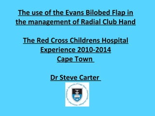 The use of the Evans Bilobed Flap in 
the management of Radial Club Hand 
The Red Cross Childrens Hospital 
Experience 2010-2014 
Cape Town 
Dr Steve Carter 
 