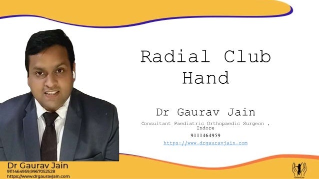 Radial Club
Hand
Dr Gaurav Jain
Consultant Paediatric Orthopaedic Surgeon ,
Indore
9111464959
https://www.drgauravjain.com
 