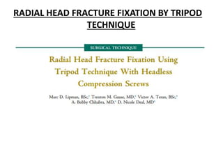 RADIAL HEAD FRACTURE FIXATION BY TRIPOD
TECHNIQUE
 