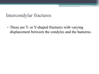 Intercondylar fractures
• These are T- or Y-shaped fractures with varying
displacement between the condyles and the humerus.
 