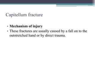 Capitellum fracture
• Mechanism of injury
• These fractures are usually caused by a fall on to the
outstretched hand or by direct trauma.
 