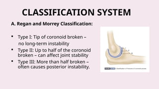 Coronoid Classification Powerpoint presentation on Radial Head and Neck Fractures | PPTX
