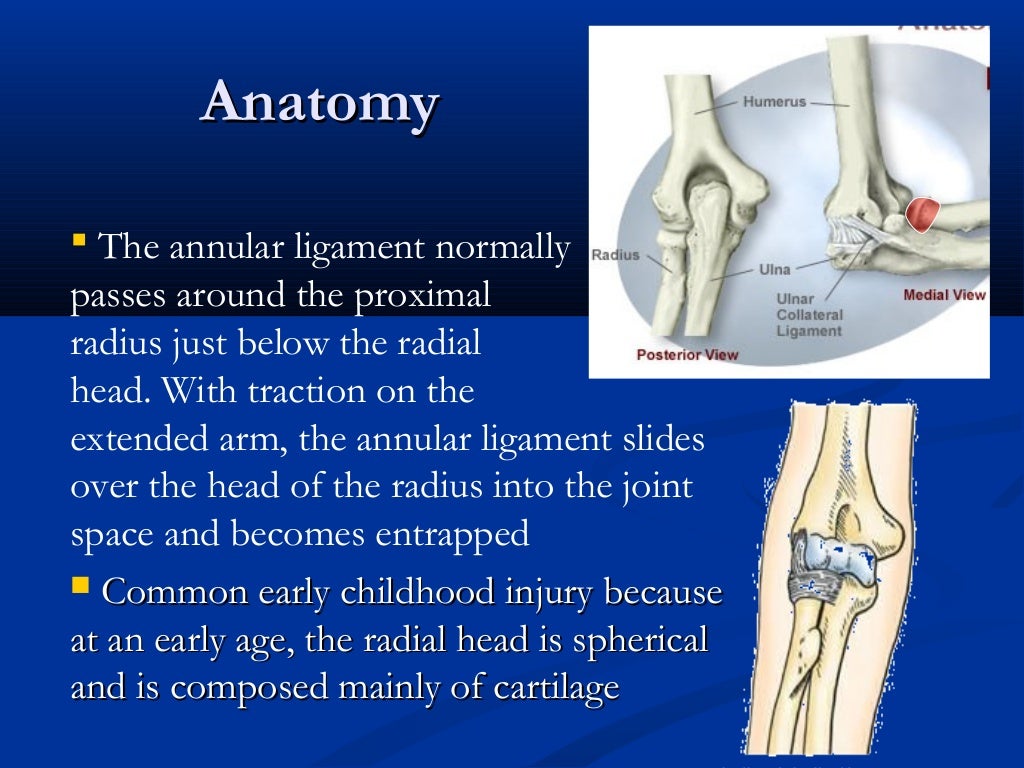 Radial head subluxation “nursemaids’ elbow”