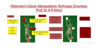 Patterson’s Classic Manipulation Technique (Courtesy:
Prof. Dr. R R Kairy)
 