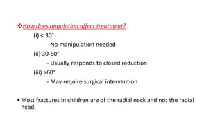 How does angulation affect treatment?
(i) < 30°
-No manipulation needed
(ii) 30-60°
- Usually responds to closed reduction
(iii) >60°
- May require surgical intervention
 Most fractures in children are of the radial neck and not the radial
head.
 