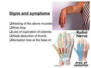 orthopedics.Radial nerve.(dr.baxtiar rasul) | PPT