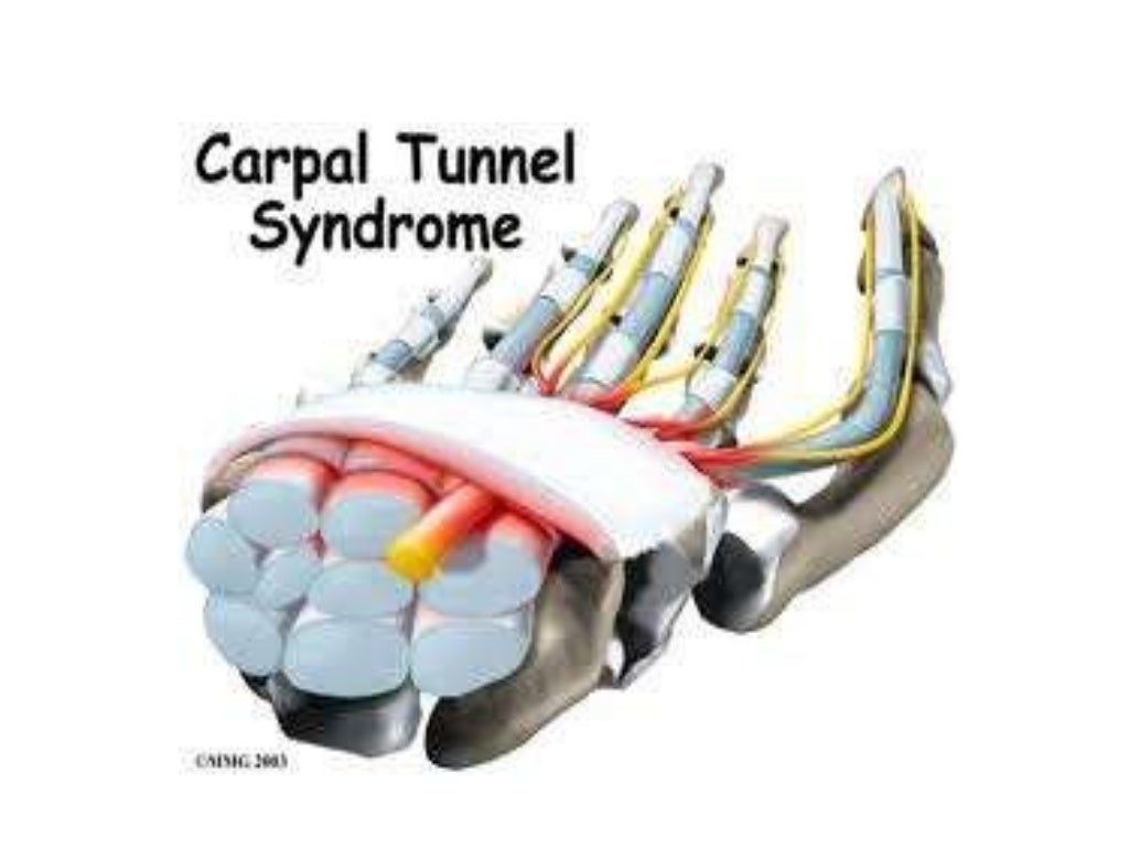 orthopedics.Radial nerve.(dr.baxtiar rasul)