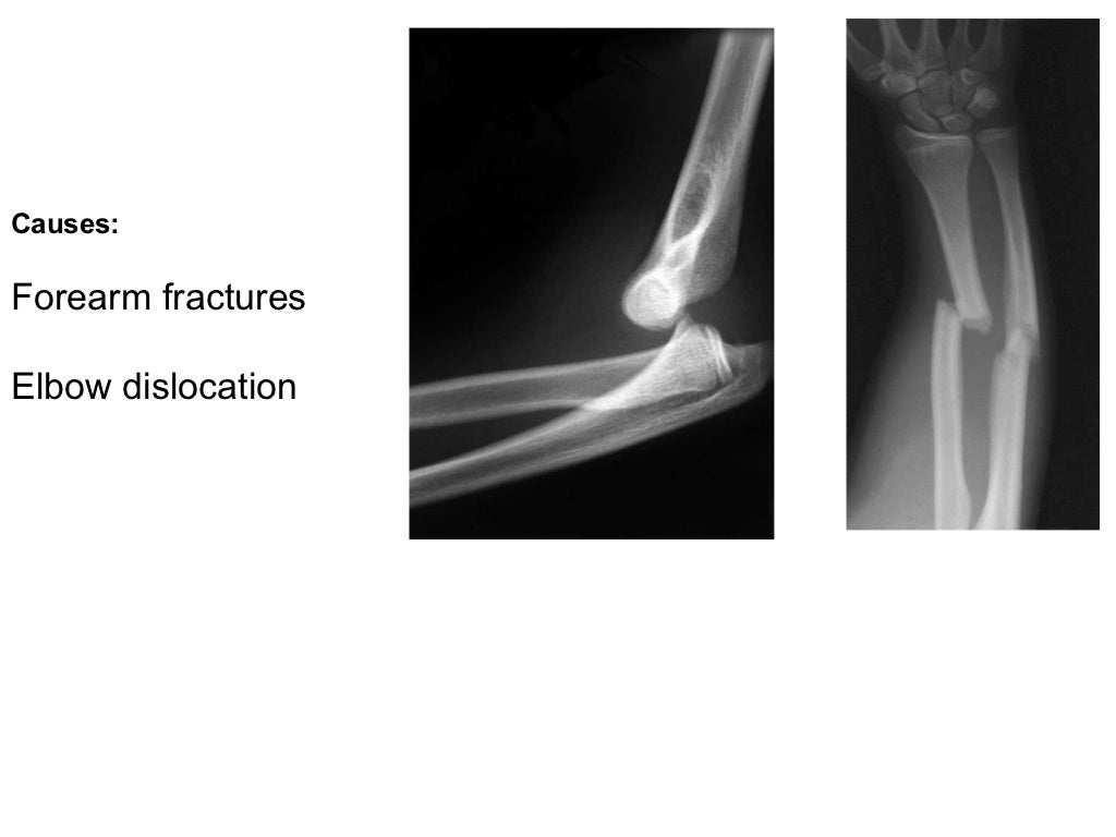 orthopedics.Radial nerve.(dr.baxtiar rasul)