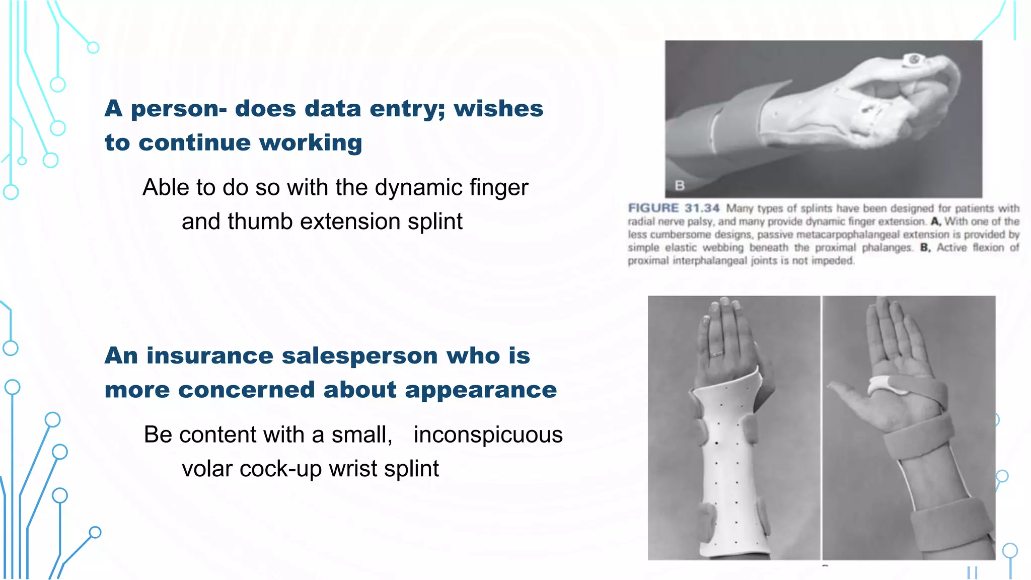 A person- does data entry; wishes
to continue working
Able to do so with the dynamic finger
and thumb extension splint
An insurance salesperson who is
more concerned about appearance
Be content with a small, inconspicuous
volar cock-up wrist splint
 