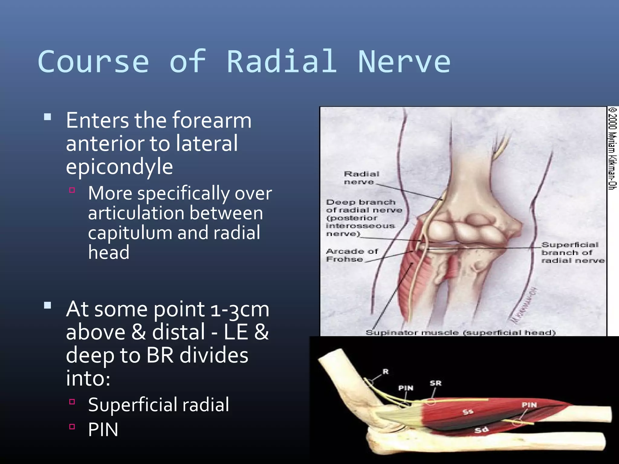 Course of Radial Nerve
 Enters the forearm
anterior to lateral
epicondyle
 More specifically over
articulation between
capitulum and radial
head
 At some point 1-3cm
above & distal - LE &
deep to BR divides
into:
 Superficial radial
 PIN
 
