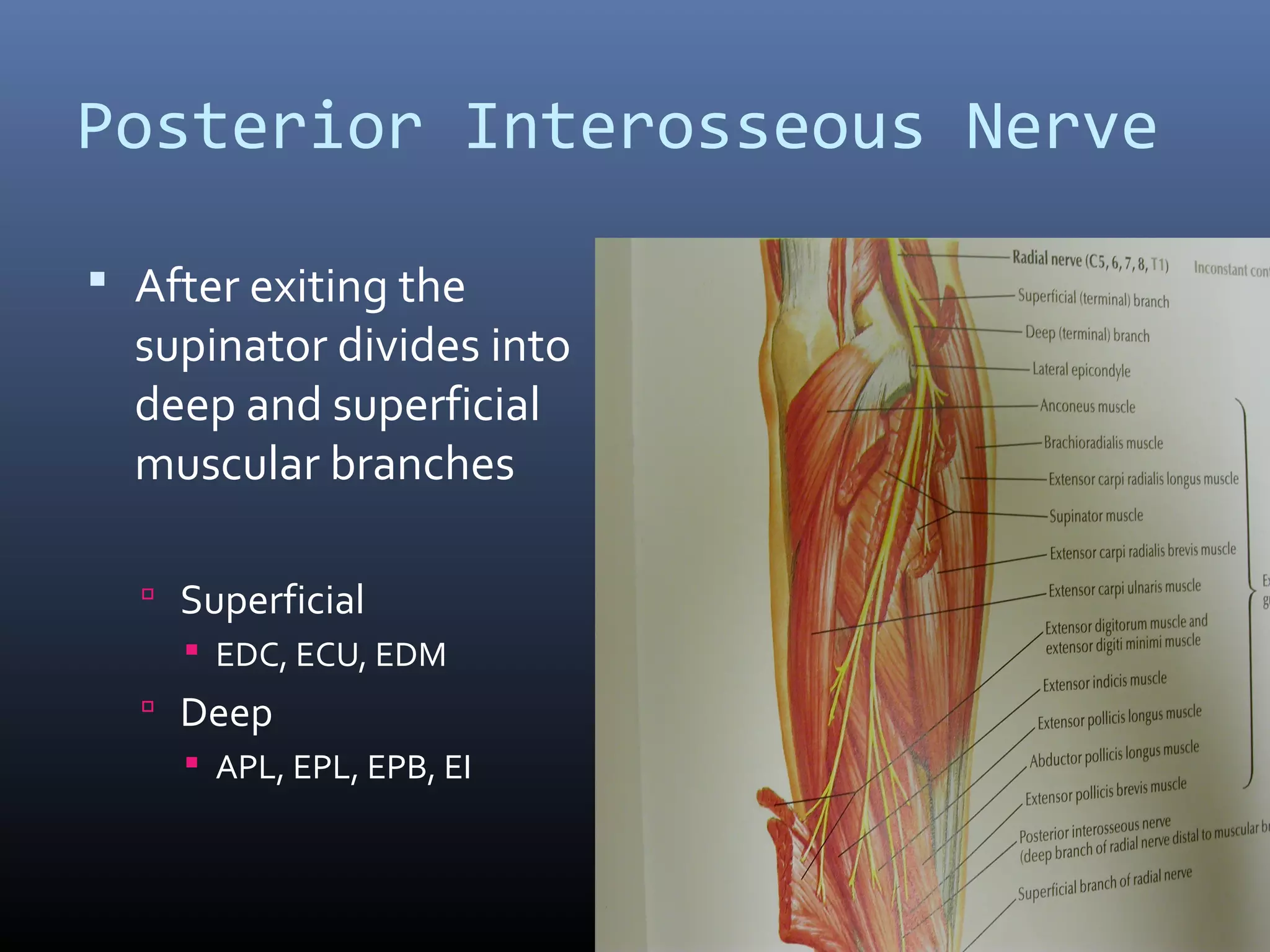 Posterior Interosseous Nerve
 After exiting the
supinator divides into
deep and superficial
muscular branches
 Superficial
 EDC, ECU, EDM
 Deep
 APL, EPL, EPB, EI
 