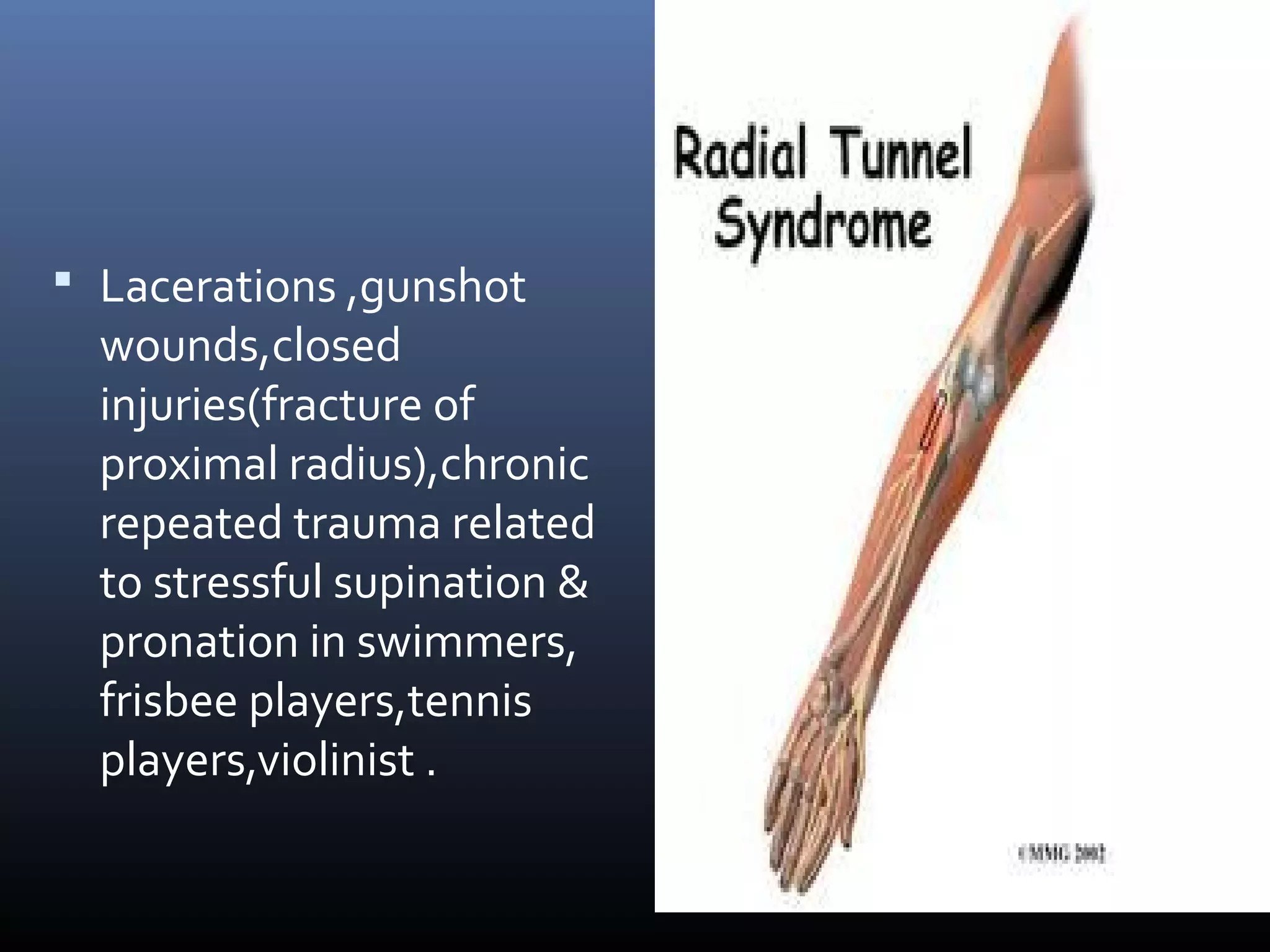  Lacerations ,gunshot
wounds,closed
injuries(fracture of
proximal radius),chronic
repeated trauma related
to stressful supination &
pronation in swimmers,
frisbee players,tennis
players,violinist .
 