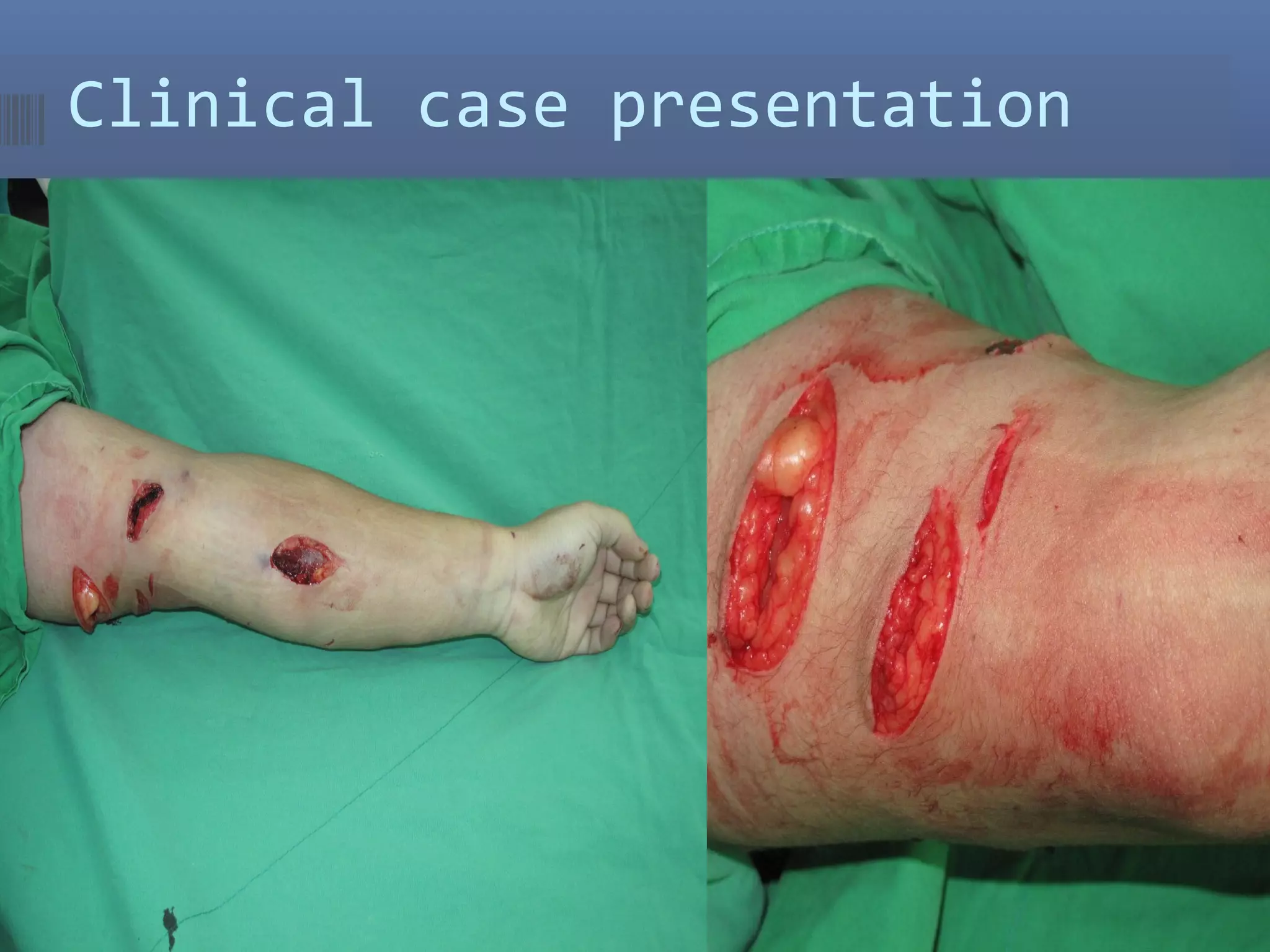 Clinical case presentation
 