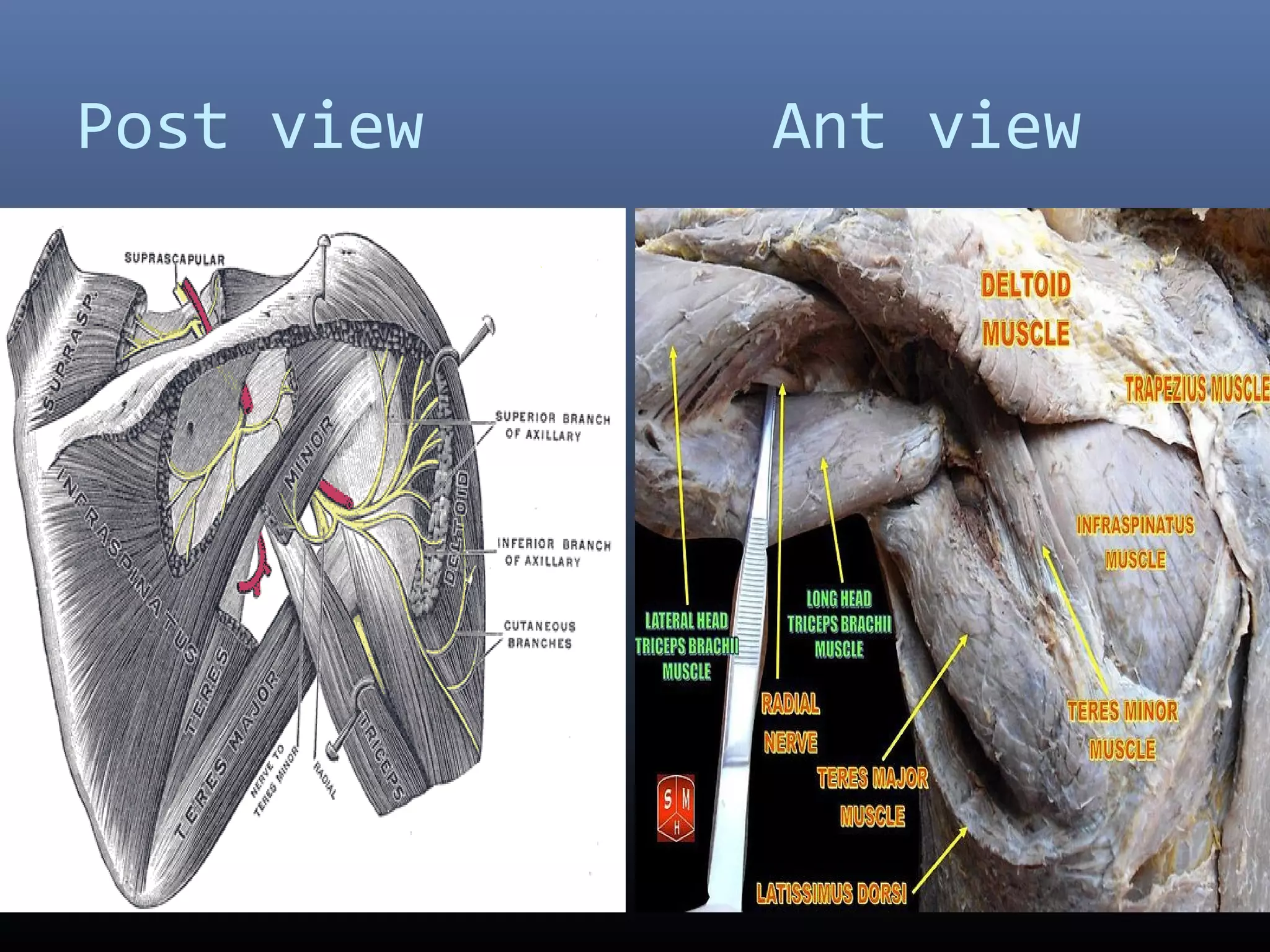 Post view Ant view
 
