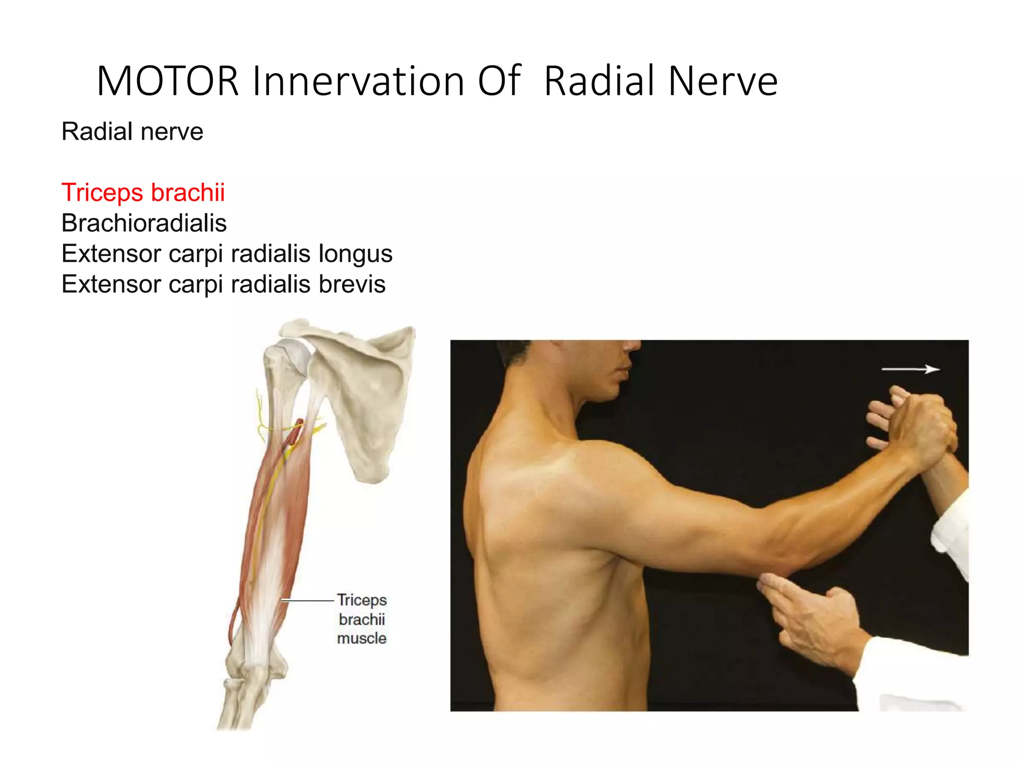 Radial Nerve Entrapment PPTX Radial Nerve Entrapment PPTX