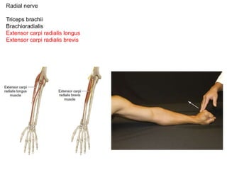 Radial nerve
Innervated muscle
Triceps brachii
Brachioradialis
Extensor carpi radialis longus
Extensor carpi radialis brevis
 