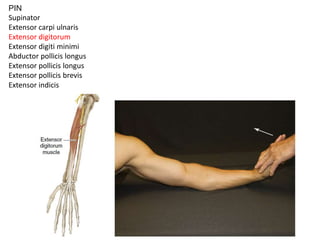 PIN
Supinator
Extensor carpi ulnaris
Extensor digitorum
Extensor digiti minimi
Abductor pollicis longus
Extensor pollicis longus
Extensor pollicis brevis
Extensor indicis
 