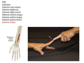 PIN
Supinator
Extensor carpi ulnaris
Extensor digitorum
Extensor digiti minimi
Abductor pollicis longus
Extensor pollicis longus
Extensor pollicis brevis
Extensor indicis
 