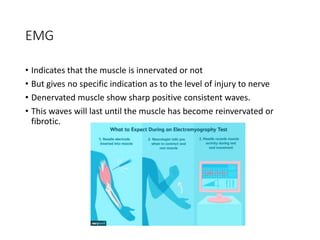 EMG
• Indicates that the muscle is innervated or not
• But gives no specific indication as to the level of injury to nerve
• Denervated muscle show sharp positive consistent waves.
• This waves will last until the muscle has become reinvervated or
fibrotic.
 