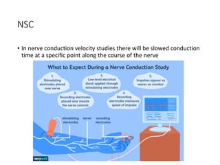 NSC
• In nerve conduction velocity studies there will be slowed conduction
time at a specific point along the course of the nerve
 