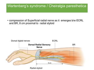 Wartenberg’s syndrome / Cheiralgia paresthetica
• compression of Superficial radial nerve as it emerges b/w ECRL
and BR, 8 cm proximal to radial styloid
Dorsal digital nerves ECRL
Dorsal Radial Sensory BR
Nerve
8 cm
Radial styloid
 