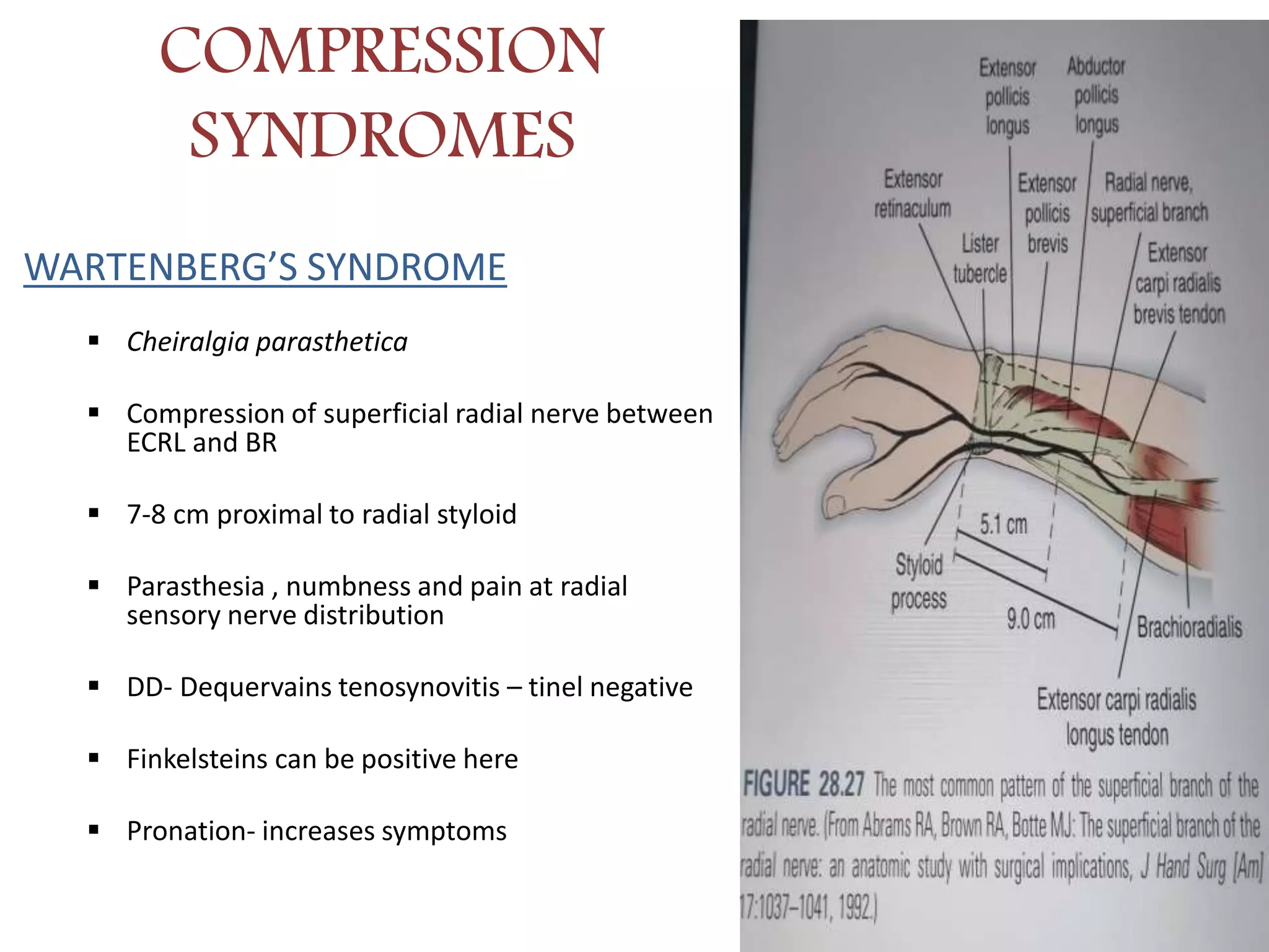 Radial Nerve Palsy PPTX