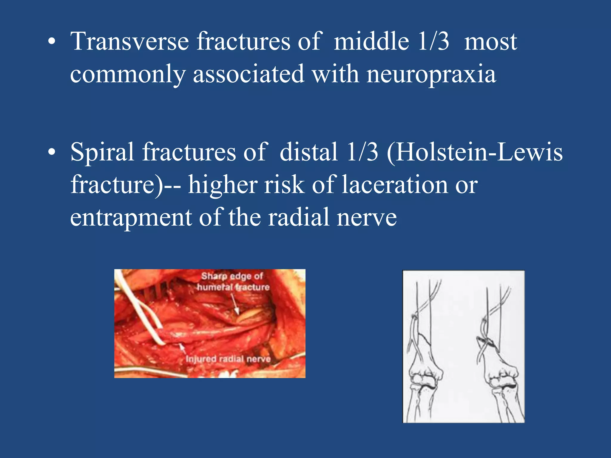 Lp Risks Nerve Radial nerve palsy | PPTX