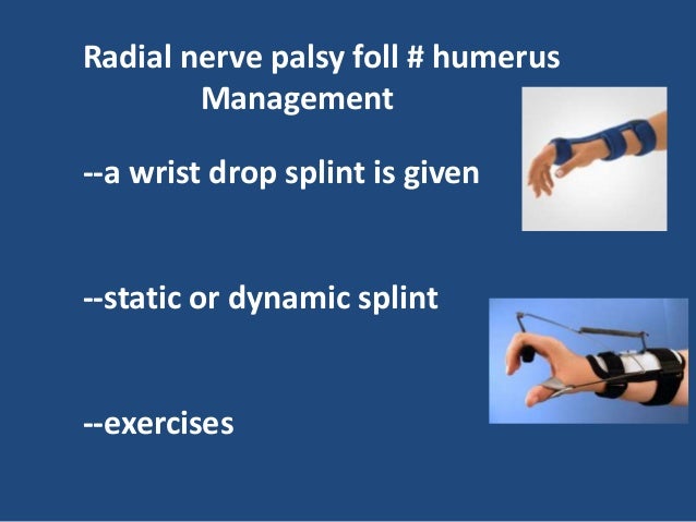 Radial nerve palsy Radial nerve palsy