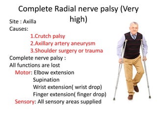 Complete Radial nerve palsy (Very
high)
Site : Axilla
Causes:
1.Crutch palsy
2.Axillary artery aneurysm
3.Shoulder surgery or trauma
Complete nerve palsy :
All functions are lost
Motor: Elbow extension
Supination
Wrist extension( wrist drop)
Finger extension( finger drop)
Sensory: All sensory areas supplied
 