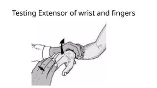 RADIAL NERVE PALSY for undergraduates .pptx