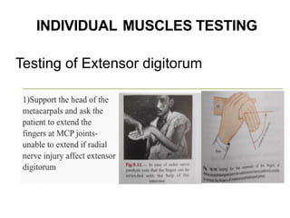 RADIAL NERVE Injuries usefu for Undergraduates | PPTX