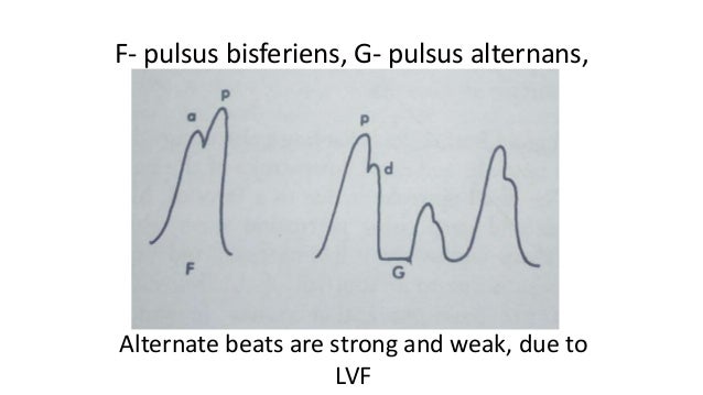 Pulsus