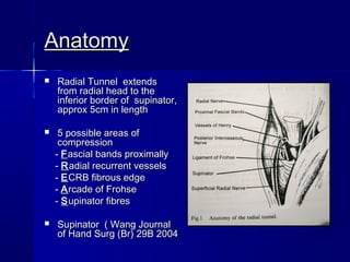 Radial tunnel syndrome | PPT