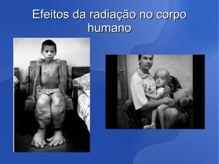Efeitos da radiação no corpoEfeitos da radiação no corpo
humanohumano
 