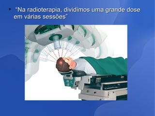 
““Na radioterapia, dividimos uma grande doseNa radioterapia, dividimos uma grande dose
em várias sessões”em várias sessões”
 
