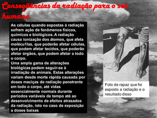 Conseqüências da radiação para o ser
humano
As células quando expostas à radiação
sofrem ação de fenômenos físicos,
químicos e biológicos. A radiação
causa ionização dos átomos, que afeta
molécu1las, que poderão afetar células,
que podem afetar tecidos, que poderão
afetar órgãos, que podem afetar a todo
o corpo.
Uma ampla gama de alterações
biológicas podem seguir-se à
irradiação de animais. Estas alterações
variam desde morte rápida causada por
doses maciças de radiação penetrante
em todo o corpo, até vidas
essencialmente normais durante
períodos variáveis de tempo até ao
desenvolvimento de efeitos atrasados
da radiação, isto no caso de exposição
a doses baixas
Foto de rapaz que foi
exposto a radiação e o
resultado disso
 