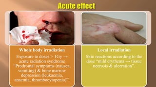 Whole body irradiation
Exposure to doses > 1Gy →
acute radiation syndrome
“Prodromal symptoms (nausea,
vomiting) & bone marrow
depression (leukaemia,
anaemia, thrombocytopenia)”.
Local irradiation
Skin reactions according to the
dose “mild erythema → tissue
necrosis & ulceration”.
 