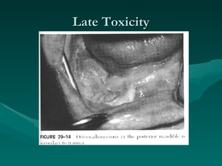 Late Toxicity 